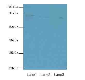 CENTB1 / ACAP1 Antibody