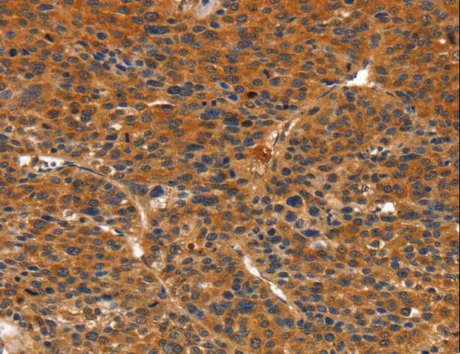 Polyclonal Rabbit anti-Human IKZF3 / AIOLOS Antibody (IHC)