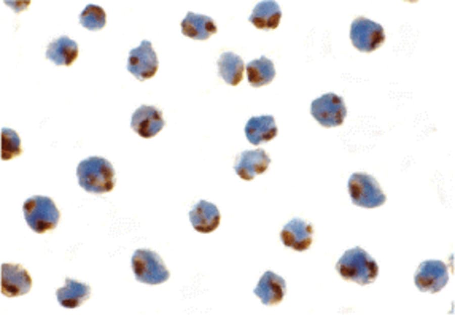 IHC-plus™ ERN1 / IRE1 Antibody
