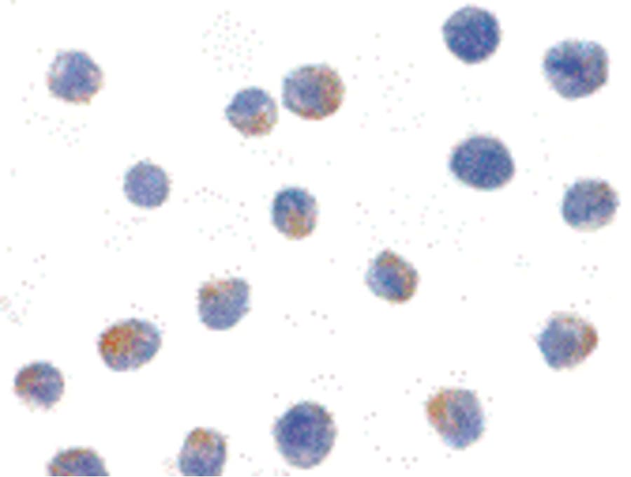 IHC-plus™ Polyclonal Rabbit anti-Human CHUK / IKKA / IKK Alpha Antibody (IHC, IF, WB)