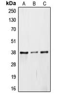 Polyclonal Rabbit anti-Human COPS5 / JAB1 Antibody (Internal, IHC, WB)