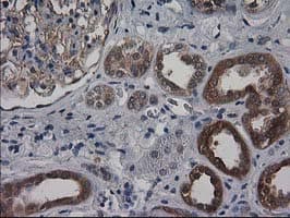 DSTN / Destrin Antibody (clone OTI1D5)
