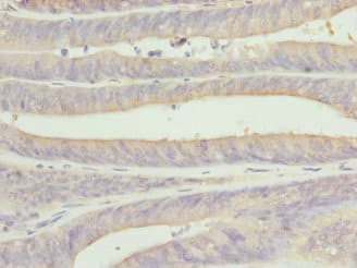 CSNK1G1 / CKI-Gamma 1 Antibody