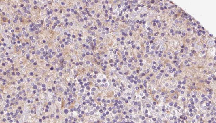 Polyclonal Rabbit anti-Human TIMM22 Antibody (IHC, IF, WB)