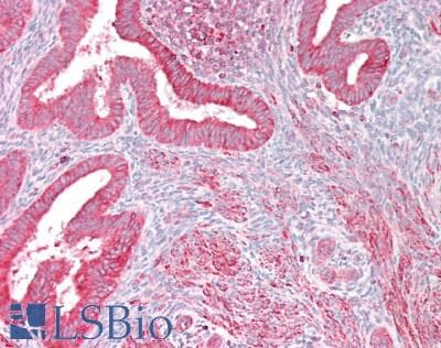 IHC-plus™ CDH11 / Cadherin 11 Antibody (aa637-796)