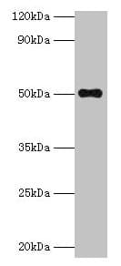 IHC-plus™ TMLHE / TMID Antibody (aa16-376)