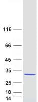 Human CRP / C-Reactive Protein (Recombinant Myc-DDK (Flag))