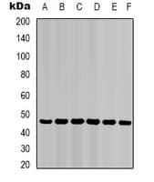 PathPlus™ KRT18 / CK18 / Cytokeratin 18 Antibody