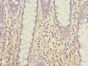 HUM2DD / DHDH Antibody