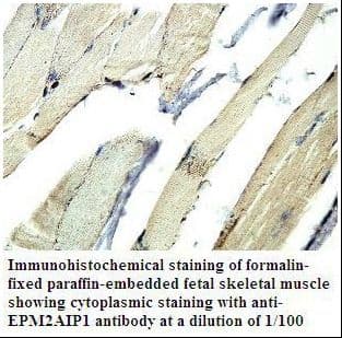 EPM2AIP1 Antibody (aa438-579)