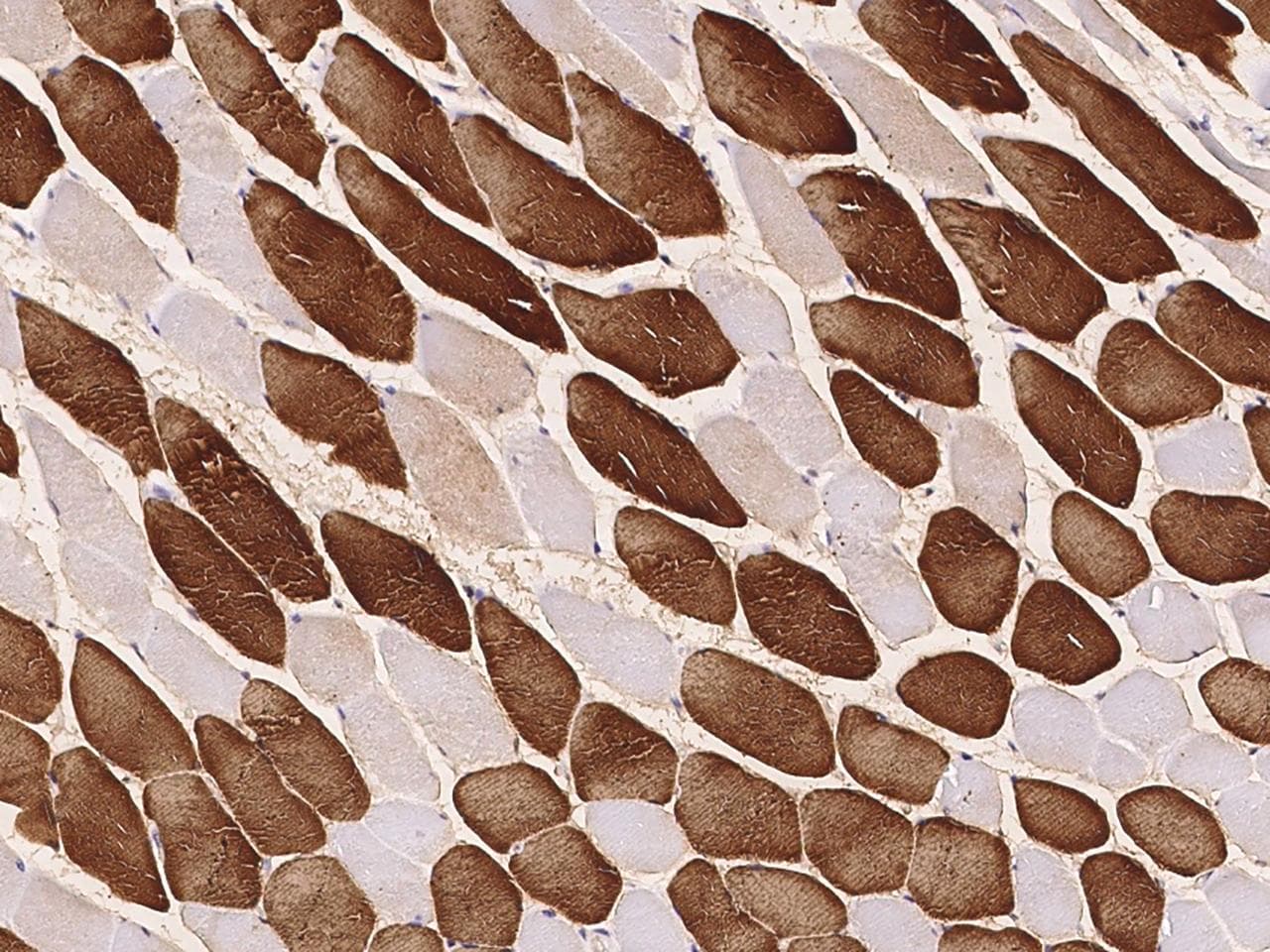 Polyclonal Rabbit anti-Human MYL2 Antibody (IHC)