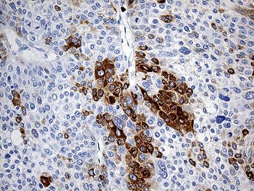TFF1 / pS2 Antibody (aa25-84, clone OTI7B12)