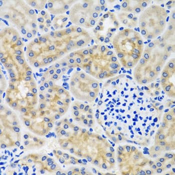 Polyclonal Rabbit anti-Human ANTXR2 / CMG2 Antibody (IHC, WB)