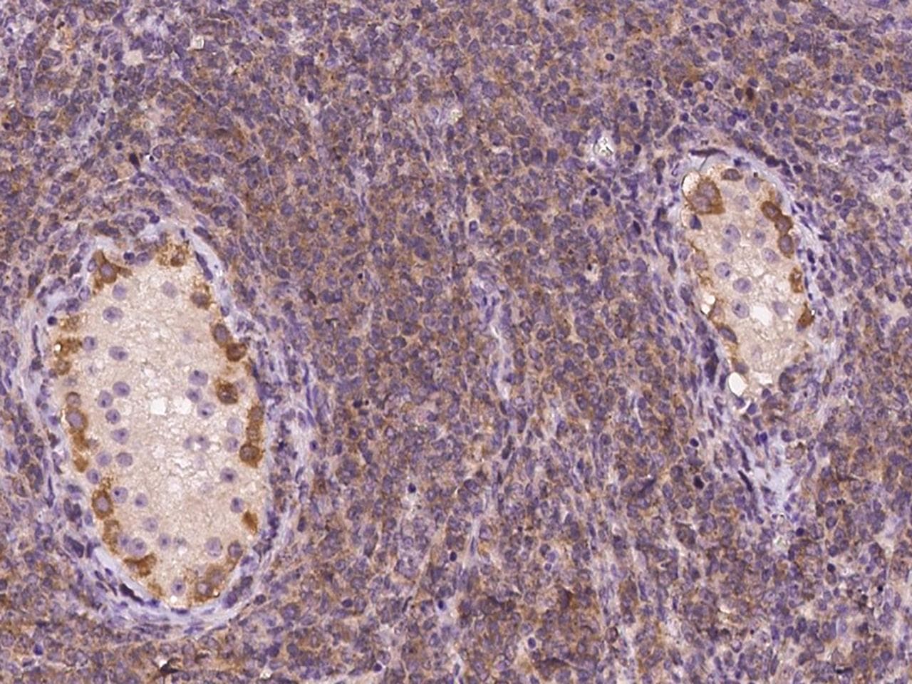MZT2A / FAM128A Antibody