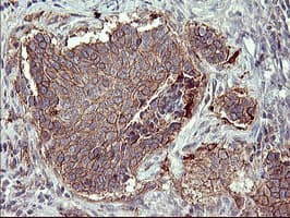 MMP13 Antibody (aa104-471, clone OTI2A6)