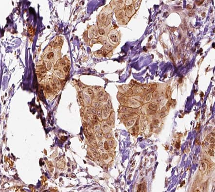 Polyclonal Rabbit anti-Human SCGB2A2 / Mammaglobin A Antibody (IHC, IF, WB)