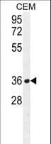 Polyclonal Rabbit anti-Human NUDT22 Antibody (aa220-249, IHC, WB)