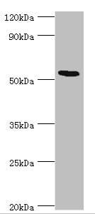 Polyclonal Rabbit anti-Human ATF7 Antibody (aa1-117, IHC, WB)