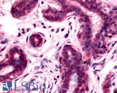 IHC-plus™ Polyclonal Rabbit anti-Human GPRC5A / RAI3 Antibody (N-Terminus, IHC)