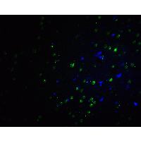 Polyclonal Rabbit anti-Human PLAGL2 Antibody (IHC, IF, WB)