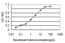 IHC-plus™ Monoclonal Mouse anti-Human ANXA5 / Annexin V Antibody (clone 1F4-1A5, IHC, IF, WB)