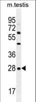 IHC-plus™ CLEC12B Antibody (aa249-276)