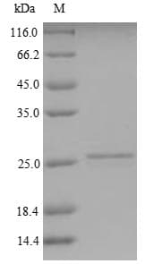 Human CT83 / CXorf61 Protein (Recombinant 6His, N-terminus)