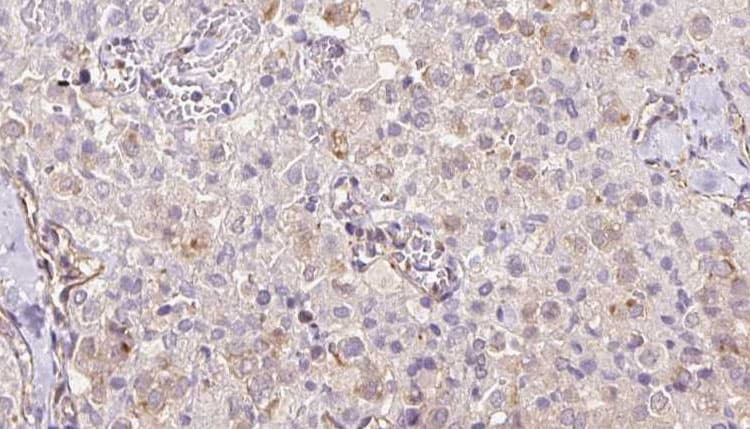 Polyclonal Rabbit anti-Human TRAPPC9 Antibody (IHC, IF, WB)