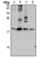 GTF2A2 / TFIIA Antibody