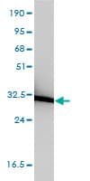 IHC-plus™ Monoclonal Mouse anti-Human ANXA5 / Annexin V Antibody (clone 1F4-1A5, IHC, IF, WB)