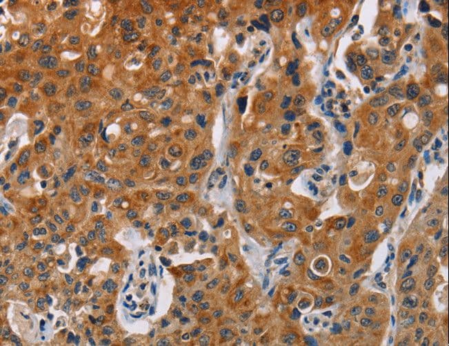 KRT13 / CK13 / Cytokeratin 13 Antibody