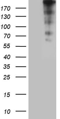 Monoclonal Mouse anti-Human CENPJ / LAP Antibody (clone OTI1E3, aa1087-1338, WB)