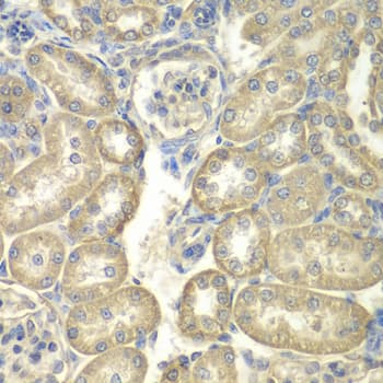 Polyclonal Rabbit anti-Human ACS5 / ACSL5 Antibody (IHC, WB)