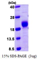 Human PPP3R1 / Calcineurin B Protein (Recombinant His)