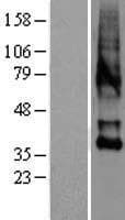 OXTR / Oxytocin Receptor Protein (Over-Expression Lysate Myc-DDK (Flag))