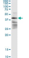 ZFYVE19 Antibody (clone 3G4-2B11)