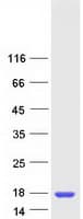 Human SSNA1 Protein (Recombinant Myc-DDK (Flag))