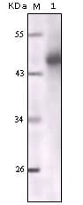 PathPlus™ Pan Cytokeratin Antibody (clone 7H8C4)