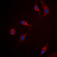 RRAD Antibody (Internal)