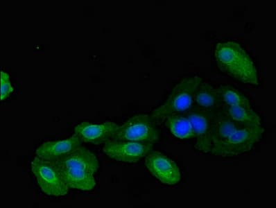 Polyclonal Rabbit anti-Human IMMT / Mitofilin Antibody (IHC, IF, WB)