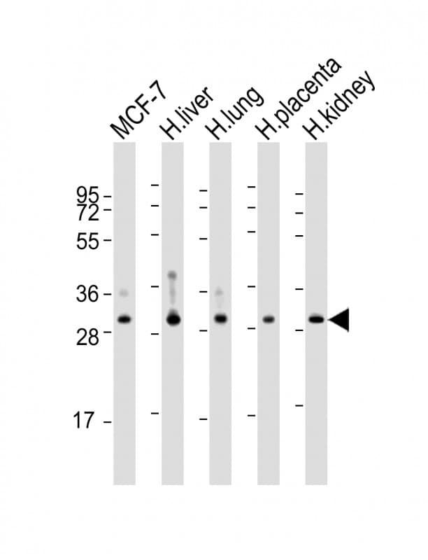 Polyclonal Rabbit anti-Human WBP1 Antibody (aa202-234, WB)
