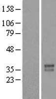 FOXR2 Protein (Over-Expression Lysate Myc-DDK (Flag))
