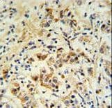 Polyclonal Rabbit anti-Mouse BID Antibody (Ser61, IHC, WB)