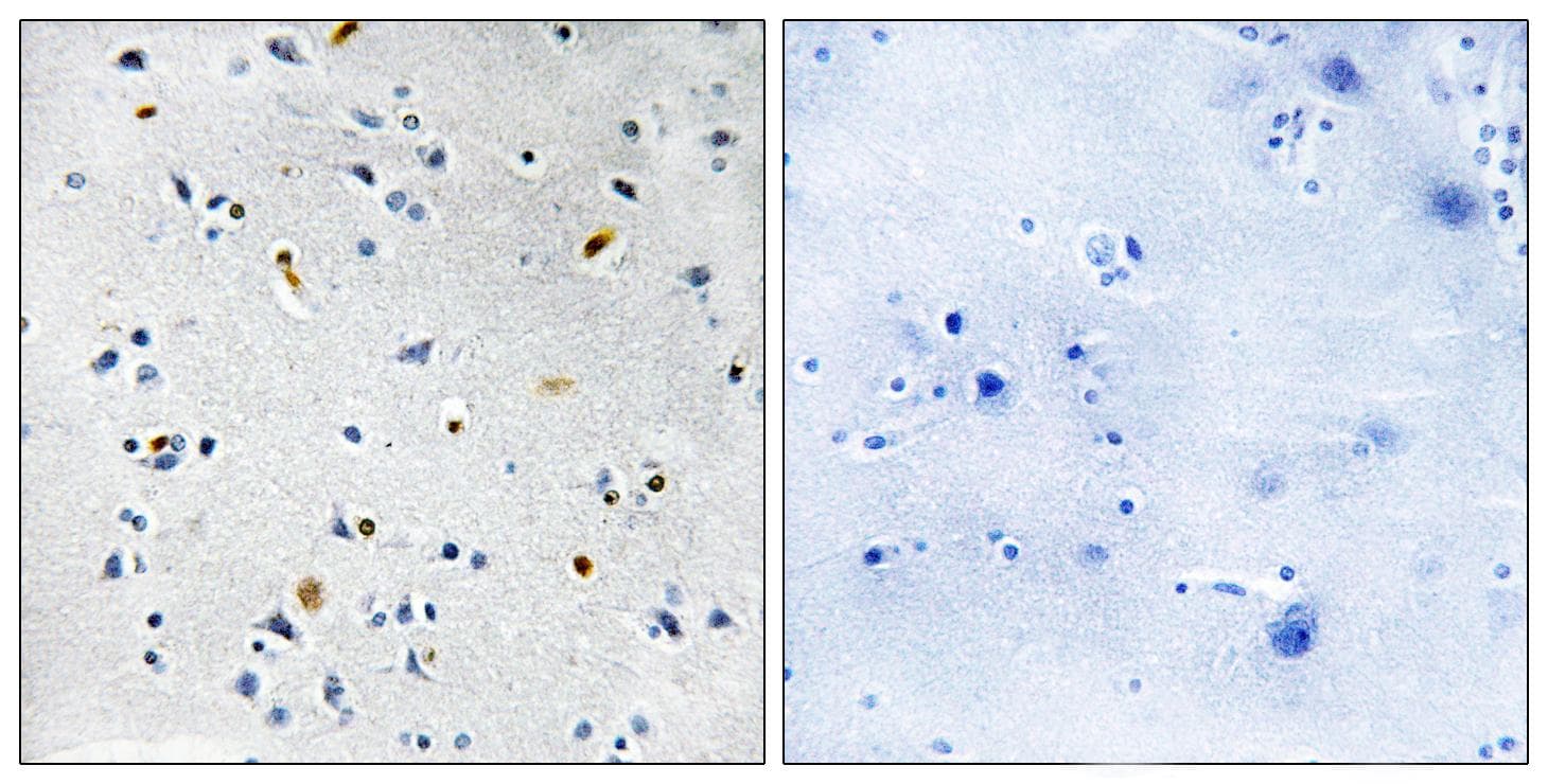 TPX2 Antibody