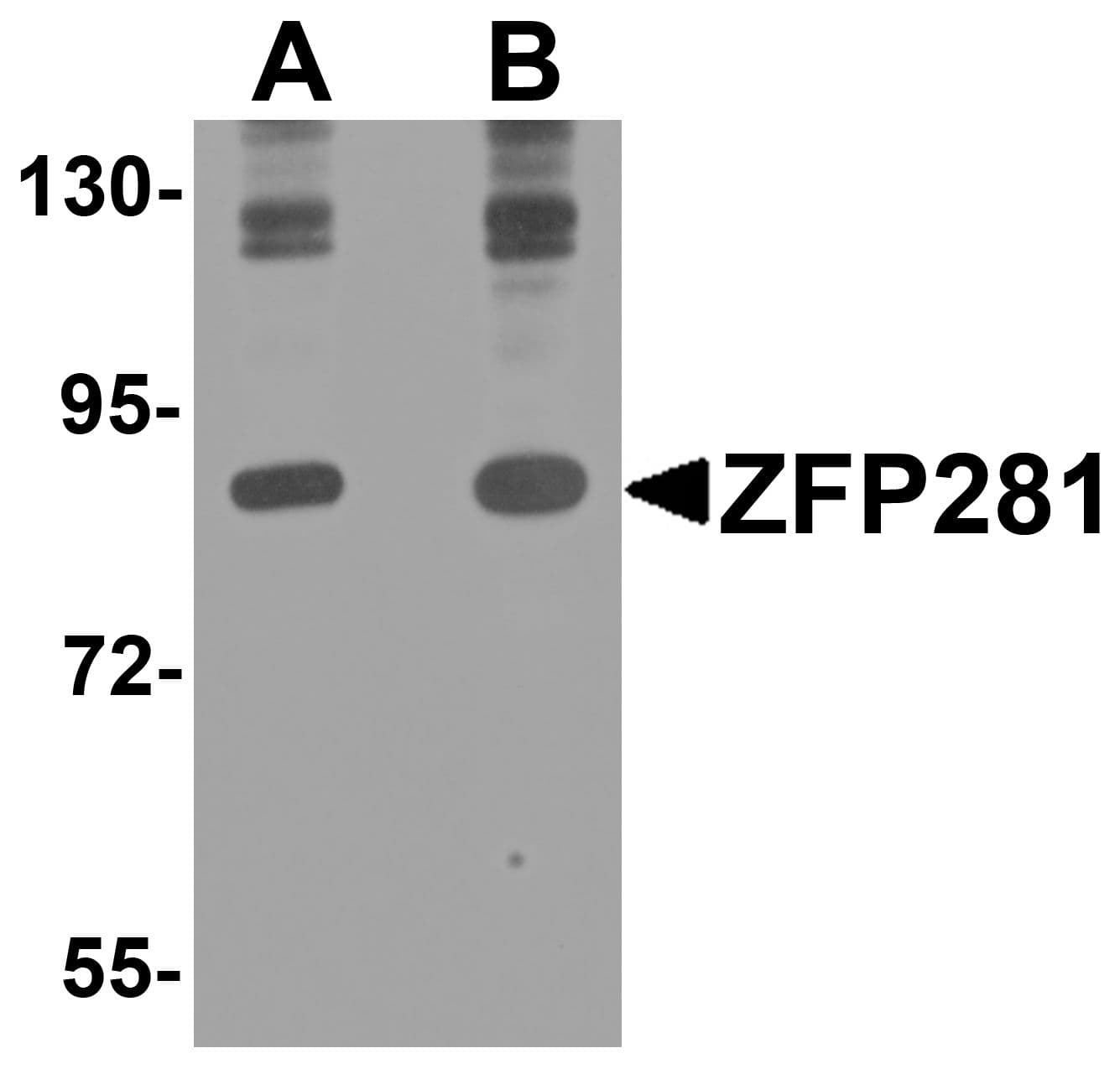 ZNF281 / Zfp281 Antibody