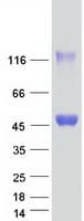Human SHARPIN Protein (Recombinant Myc-DDK (Flag))