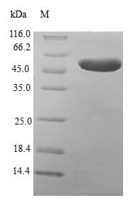 Human MLC3F / MYL1 Protein (Recombinant GST, N-terminus)