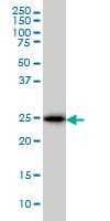 CD99 Antibody (clone 3A10)