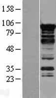 MRPL19 Protein (Over-Expression Lysate Myc-DDK (Flag))