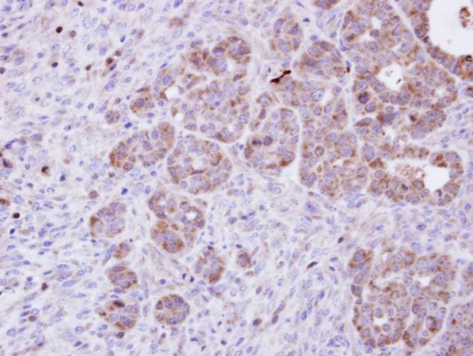 Polyclonal Rabbit anti-Human AMPH / Amphiphysin Antibody (aa1-194, IHC, WB)